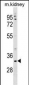 TMEM178 Antibody (Center)